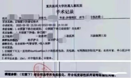 恶性肌纤维母细胞性肉瘤，获重疾险理赔80万(图2)